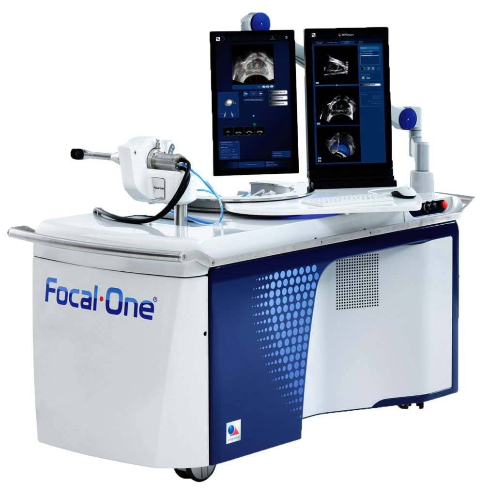 Focal One Robotic Focal HIFU Non-Invasive Prostate Cancer Treatment