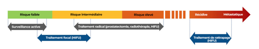 Evolution du cancer de la prostate