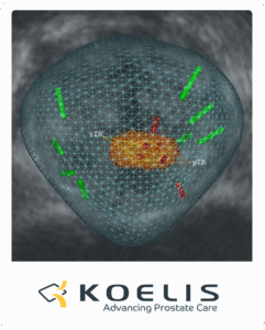 FocalOne_with_Koelis