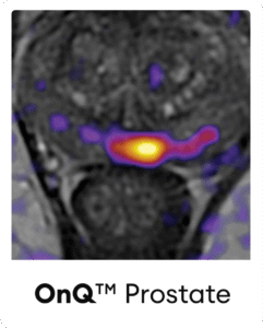 FocalOne_with_OnQ